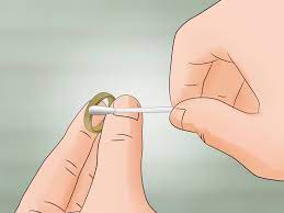 Check spelling or type a new query. 3 Ways To Cure A Skin Rash Under A Ring Wikihow