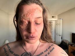 Medusa from Classical Greek literature had way too much fun learning hands  and clothing techniques just wanted to share background is from a quick  Google search not that advanced 😂 *Edit -