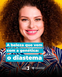 O diastema é o espaço natural entre dois dentes, frequentemente entre os  incisivos centrais superiores. Essa característica dental é  predominantemente genética e pode ser transmitida de pais para filhos. 🧬  Em algumas