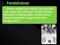 Diafragma merupakan sekat yang membatasi. Hernia Diafragmatika Ppt Download