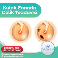 kulak zarinda delik tedavisi kulak tibbi tip