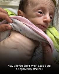 How are you silent when babies are being forcibly starved? The occupation  has now blocked food from entering Gaza for the 78th day in a row. Children  are being starved to death.