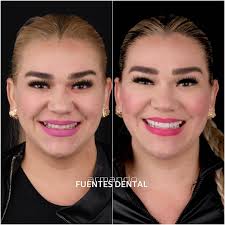 👨🏻‍⚕️ C.D. Armando