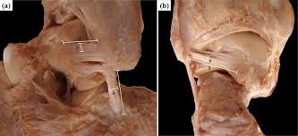 The patellofemoral articulation, consisting of the patella, or kneecap, and the patellar groove on the front of the femur through which it slides; Measurement Site Of The Lateral Ankle Ligaments A Lateral View And B Download Scientific Diagram