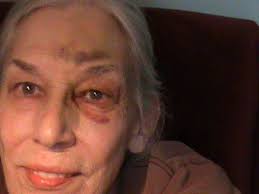 What Happened To My Face?