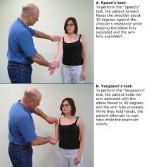 Image result for Yergason Test