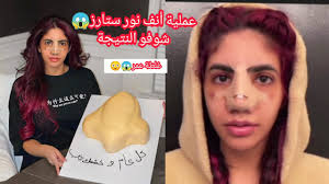 وجاء في قرار مجمَعِ الفقه الإسلامي: Ù†ÙˆØ±Ø© Ø§Ù„Ø¹Ù…ÙŠØ±ÙŠ Ø¨Ø¹Ø¯ Ø¹Ù…Ù„ÙŠØ© Ø§Ù„ØªØ¬Ù…ÙŠÙ„