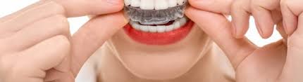 Braces straighten teeth because they do two very important things: The Risks Of Diy Braces Mehta Orthodontics
