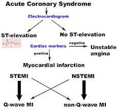 Acs carries significant morbidity and mortality and the prompt diagnosis, and appropriate treatment is essential. Acute Coronary Syndrome Wikipedia