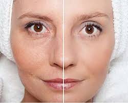 Masques De Nuit Pour Eliminer Les Rides Et Les Taches Sur La Peau En 10 Jours Rides Taches Pea Anti Aging Oils Beautiful Skin Care Anti Wrinkle Treatments