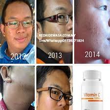 Vitamin c 1000mg adalah keluaran pahang pharma, no kkm mal06051404x. Vitamin C 1000mg Review Testimoni Pp Vitamin C Pahang Pharmacy