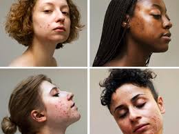 This is what I've learned from over a decade with acne... — Rowan Ellis