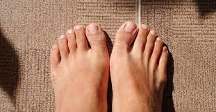 Image result for Clubbing nails feet