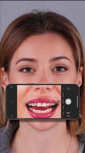 Create stunning videos effortlessly with our Dentiphoto app! • 50+  ready-to-use templates • Generate a complete video in just 3 minutes •  Simply upload your photos and let the app do the ...
