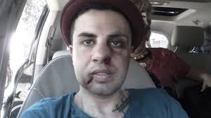 كما قدّم بيومي فؤاد برنامج بيومي أفندي، وهو عبارة عن إسكتشات كوميدية. Ø¬Ø§Ø¯ Ø´ÙˆÙŠØ±ÙŠ ÙŠÙˆØ¶Ø­ Ø­Ù‚ÙŠÙ‚Ø© Ø§Ù„ØµÙˆØ±Ø© Ø§Ù„Ù…Ù†Ø´ÙˆØ±Ø© Ù„Ù‡ ÙˆÙ‡Ùˆ Ù…Ø¶Ø±ÙˆØ¨ Ù…Ù‚Ø·Ø¹ Ù…Ù† ÙƒÙˆØ§Ù„ÙŠØ³ Ø¢Ø®Ø± Ø£Ø¹Ù…Ø§Ù„Ù‡ ÙÙ† ÙˆØ«Ù‚Ø§ÙØ© Ø§Ù„ÙˆØ·Ù†