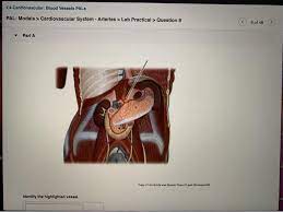 Solved 4 Cardiovascular Blood Vessels Pals Pal Models Chegg Com