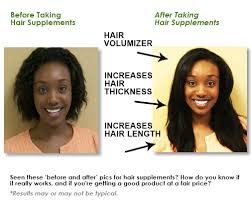 More than 1500 msm hair growth before and after at pleasant prices up to 54 usd fast and free worldwide shipping! Msm Gummies We Also Recommend