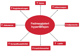 I denne artikkelen gis en oversikt over de genetiske aspektene ved fedme. Fedme Og Hypertensjon Indremedisineren