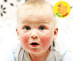 Tratament oxiuri la copii tratamentul medicamentos, folosit in asociere cu reguli stricte de igiena, va trata infectia cu oxiuri. Dermatita La Bebe De 5 Luni Wasatchpremiermovers Com