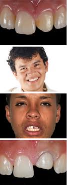 Clinical Case Reports: Vol 8, No 12