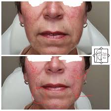 Beauty Resurfaced, PLLC