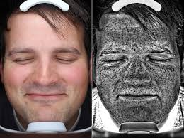 Skin cancer — the abnormal growth of skin cells — most often develops on skin exposed to the sun. What If You Could Spot Skin Cancer Before It Got Too Serious Eurekalert Science News