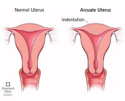 Image result for uterus