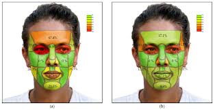 Smartphone-Based Facial Scanning as a Viable Tool for Facially Driven  Orthodontics?