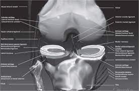 Mri patterns of neuromuscular disease involvement thigh & other muscles 2. Knee Mri Radiology Key