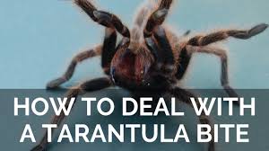 Image result for Tarantula Bite