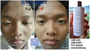 Maybe you would like to learn more about one of these? Jual Trulum Skincare Di Bukit Kecil Kota Palembang Wa 0811 233 8376 Trulum Merupakan Produk Skincare Perawatan Wajah Terlaris Aba Perawatan Wajah Serum Toner