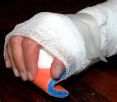 Image result for Hand Injury