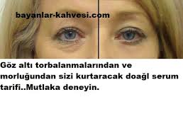 Goz Alti Torbalanmasindan Morluklardan Kurtaran Dogal Serum Natural Serums Eye Bags Bruises
