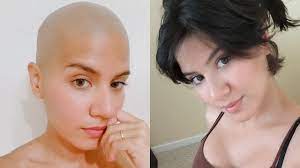 Find all the books, read about the author, and more. One Year Of Hair Growth Shaved Head Youtube