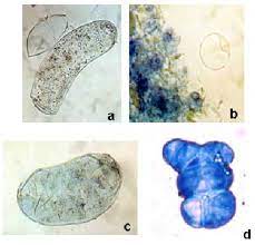 Check spelling or type a new query. Cells And Protoplasts Stained With Evans Blue A Non Stained Cells Download Scientific Diagram