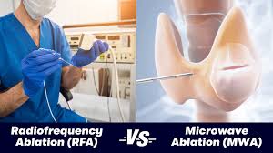 Image result for Radiofrequency Surgery