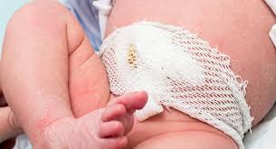 We did not find results for: Strange But True Babies Born With No Belly Button Babycenter