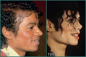 The late music icon had many plastic surgery procedures to alter his appearance in the last 25 years of his life. Keep The Faith If Someone Ever Tells You That Michael Jackson Had