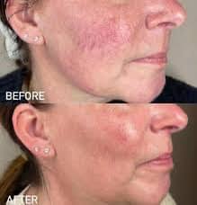 From all of us at Touch & Glow Medical Aesthetics, We would like to wish  you a Merry Christmas and a Happy New Year! May this holiday season be a  time of