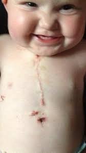 Mom had daughters heart operation scar tattoo