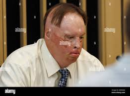 Portland, USA. 01st Aug, 2023. John Hacker, the principal target of Ngo's  lawsuit, sits by the defense table. Andy Ngo, a prominent right-wing media  personality, brings a civil lawsuit against Rose City