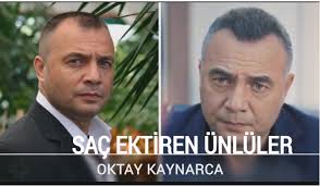 Oktay Kaynarca Sac Ekimi Ve Ekim Merkezi Sac Ekimisac Ekimi
