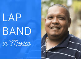 Lap banding for weight loss in an aging population. Lap Band In Mexico Gastric Banding Tijuana Bariatrics Center