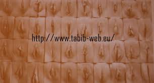 طبيب الوب أسئلة حول التبدلات بشكل الجهاز التناسلي