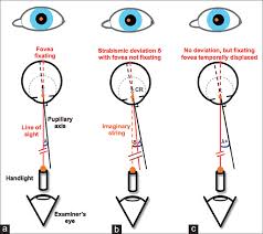 Image result for artistic divergence eyeballs