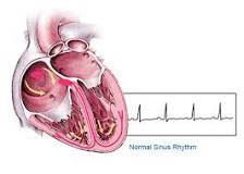 Image result for icd 10 dx code for afib with rvr
