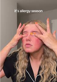 Finally being able to scratch my eyes after wearing makeup all day>>  #spring #allergyseason #allergies