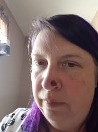 When Heidi Zentz noticed a small spot