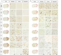 Illumina sequencing count data from mapped reads and meta data from the mirna body atlas consisting of 21 and 23 tissues (14 organs) of toxicologic interest from 12 to 13 week old male and. Spatiotemporal Protein Atlas Of Cell Death Related Molecules In The Rat Mcao Stroke Model Abstract Europe Pmc