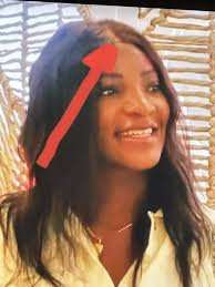 10 minutes in, & a lie has already been told! It doesn't take months to  find ￼ gallstones 🧐 She's lost 50lbs? Veah's lying 🤥